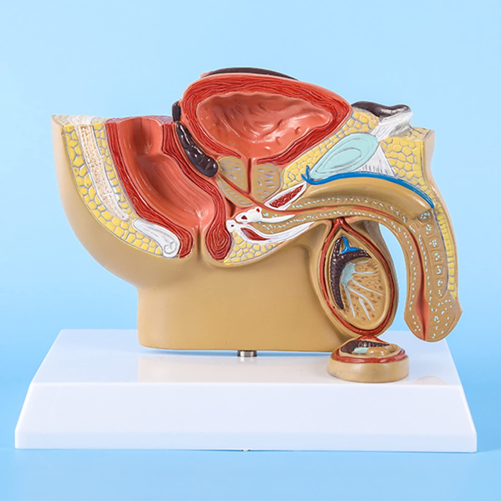 CcacHe Modelo de anatomía pélvica Masculina, Modelo anatómico patológico, Modelo de órgano médico para Estudio de investigación de Estudiantes de Medicina