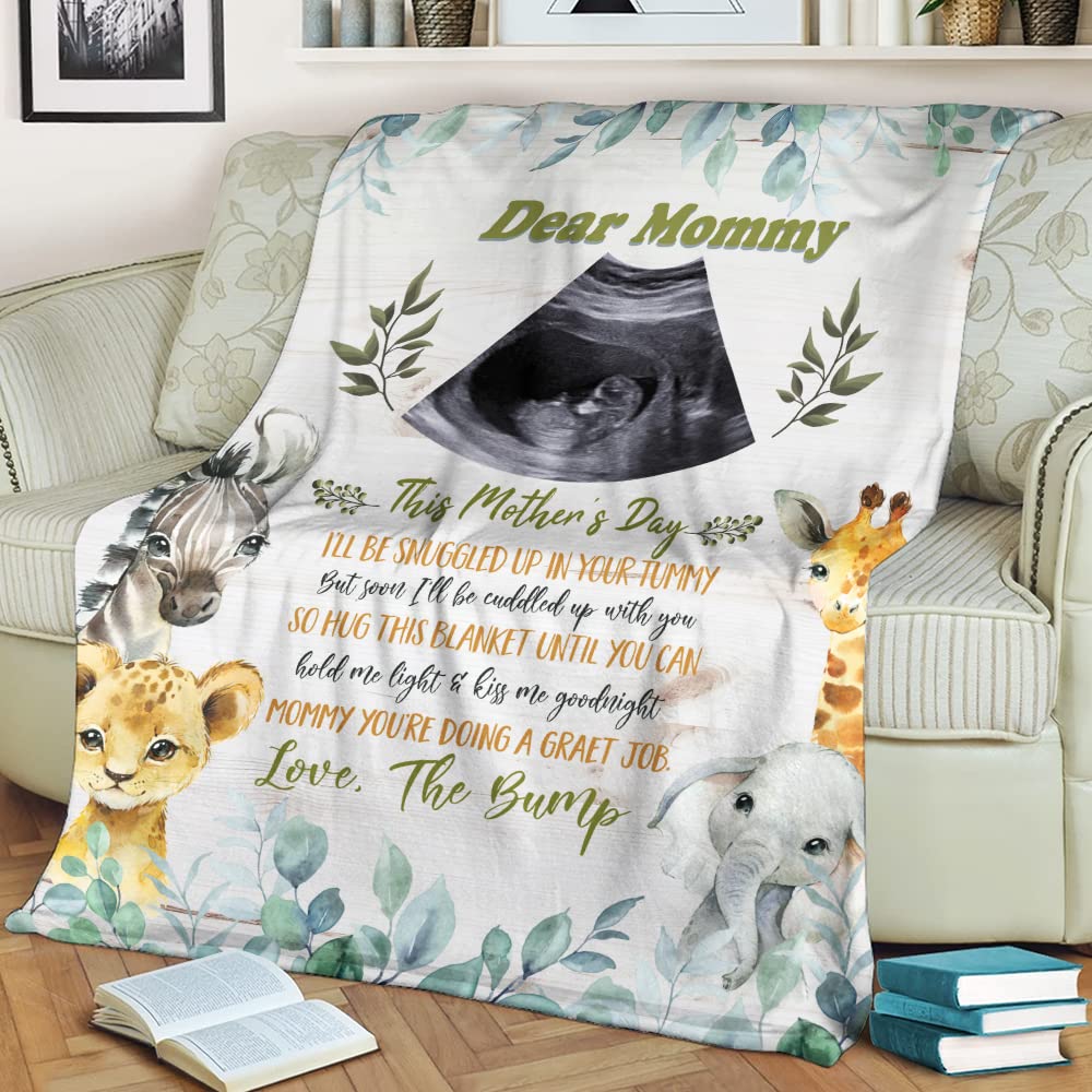 Personalized Baby Ultrasound Photo Blanket - Custom Sonogram Throw For New Mom, Mother's Day & Pregnancy Gifts