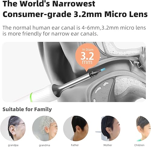 Miniatura 5 de Bebird Pro Note5 - Recogedor de orejas con pinzas para cámara, herramienta inalámbrica de eliminación de cera, otoscopio limpiador de cámara con luz