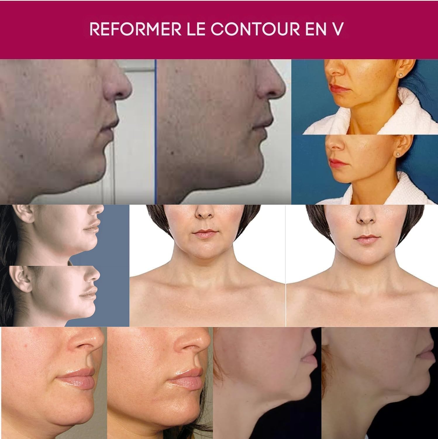 Crème pour le cou avancée - Crème anti-âge pour le cou, le menton et la mâchoire pour femmes et hommes 30 ml