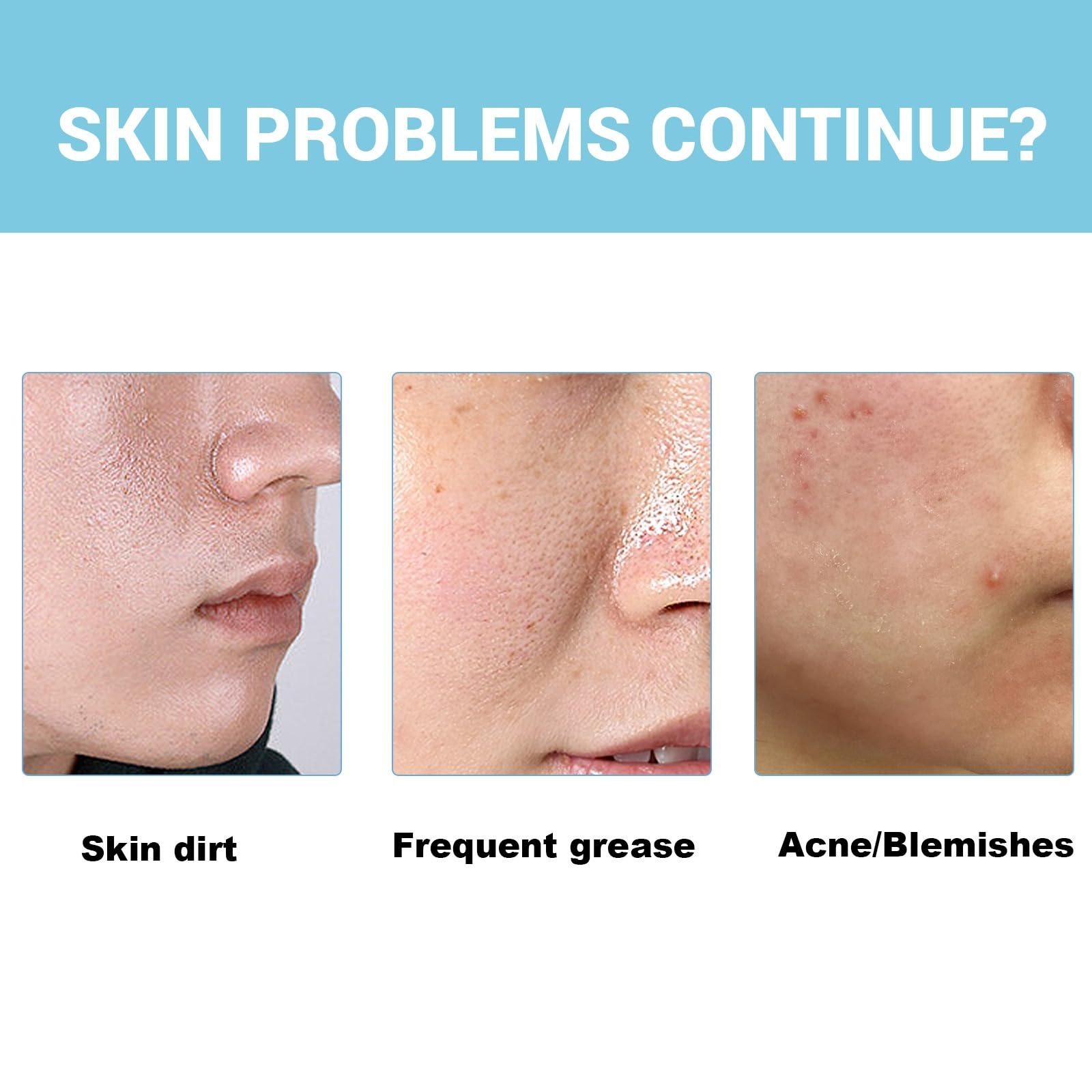 Acne Foaming Wash,Acne Foam Wash,Gentle Daily Cleansing Foam for Deep Pore Cleansing,Moisturising Face Wash,Facial Wash Women to Soothe Redness and Balance Oil,Exfoliating Face Wash - Image 4
