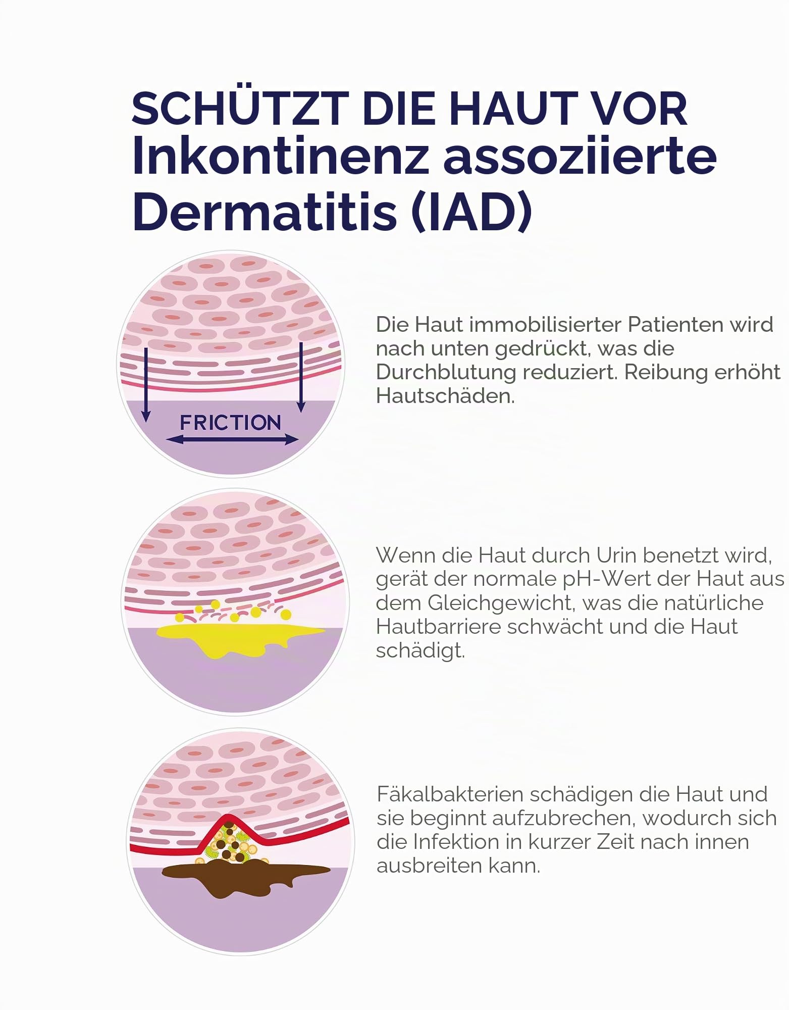 DYMACARE® Inkontinenz Pflege Waschhandschuh - Reinigung-Hautpflege-Hautschutz in einem Arbeitsgang (30 Packungen)