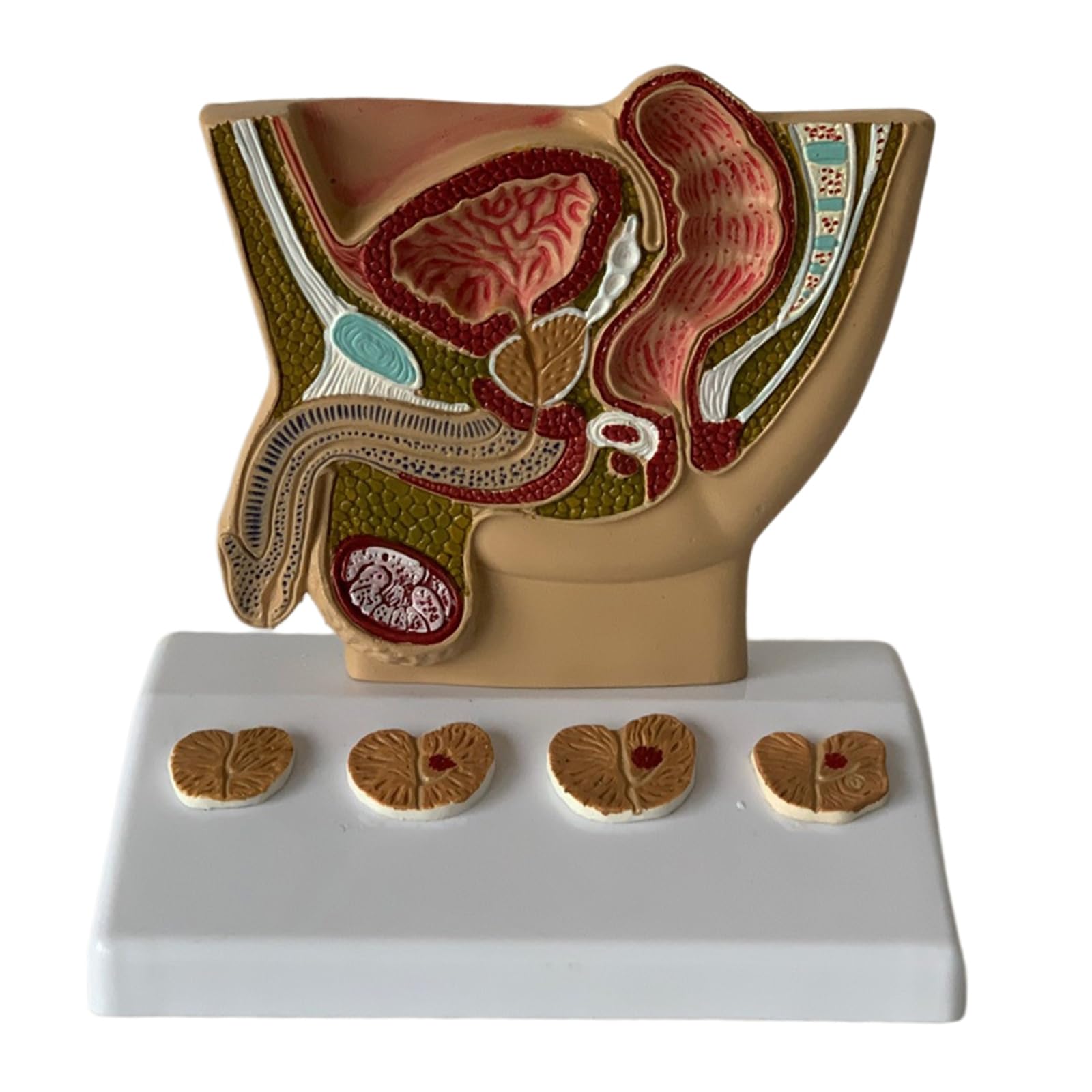 LKYLVEE Bladder Abdominal Model - Human Organ Anatomical Model Human Abdominal Cavity, Bladder and Prostate Model - for Study Teaching Display,Male Abdominal Cavity
