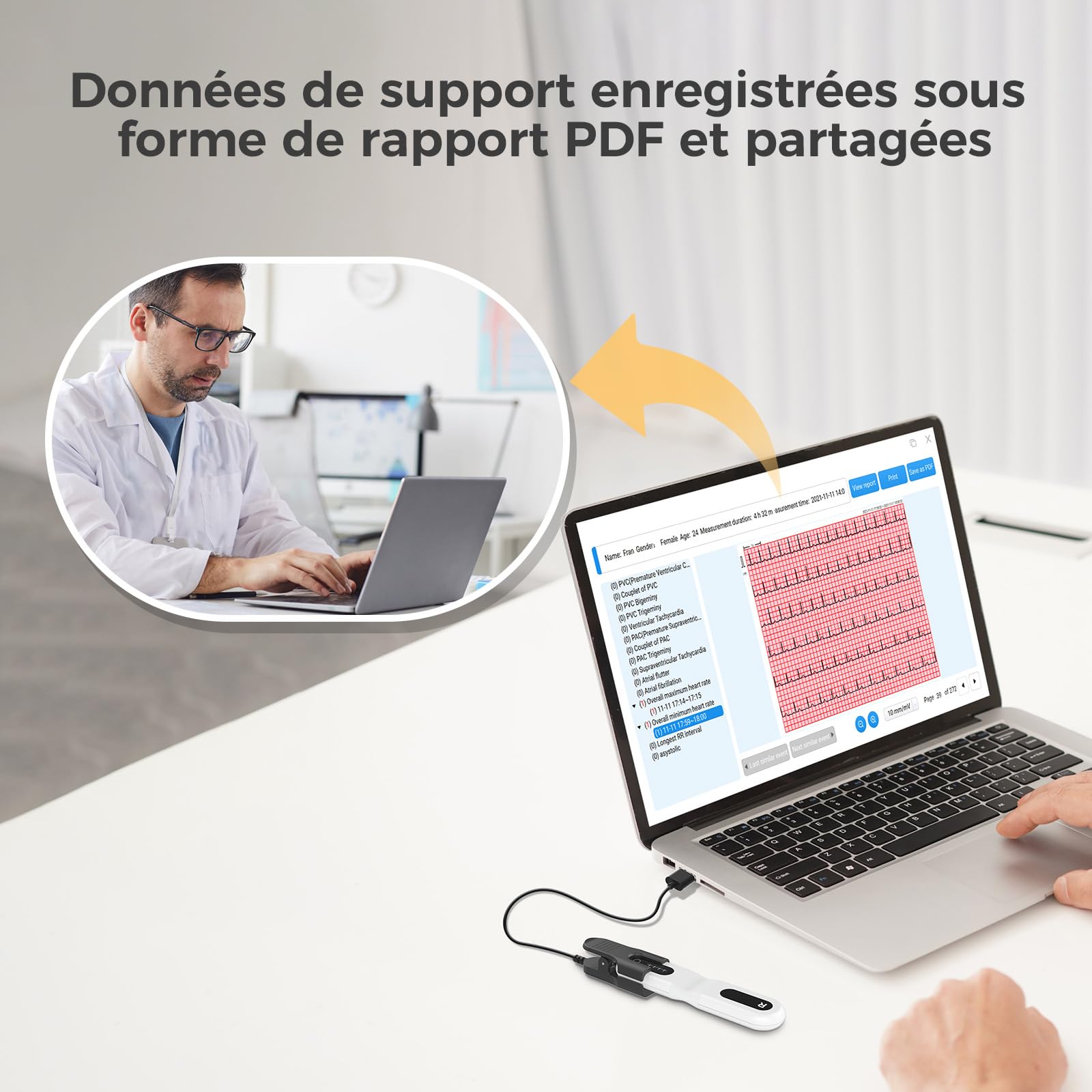 CheckMe ER1-LW Moniteur ECG Portable 72 Heures avec Analyse ECG AI, Fonction Marqueur D'événement ECG, App & PC-software, Compatible avec Les Électrodes à pression de 4 mm