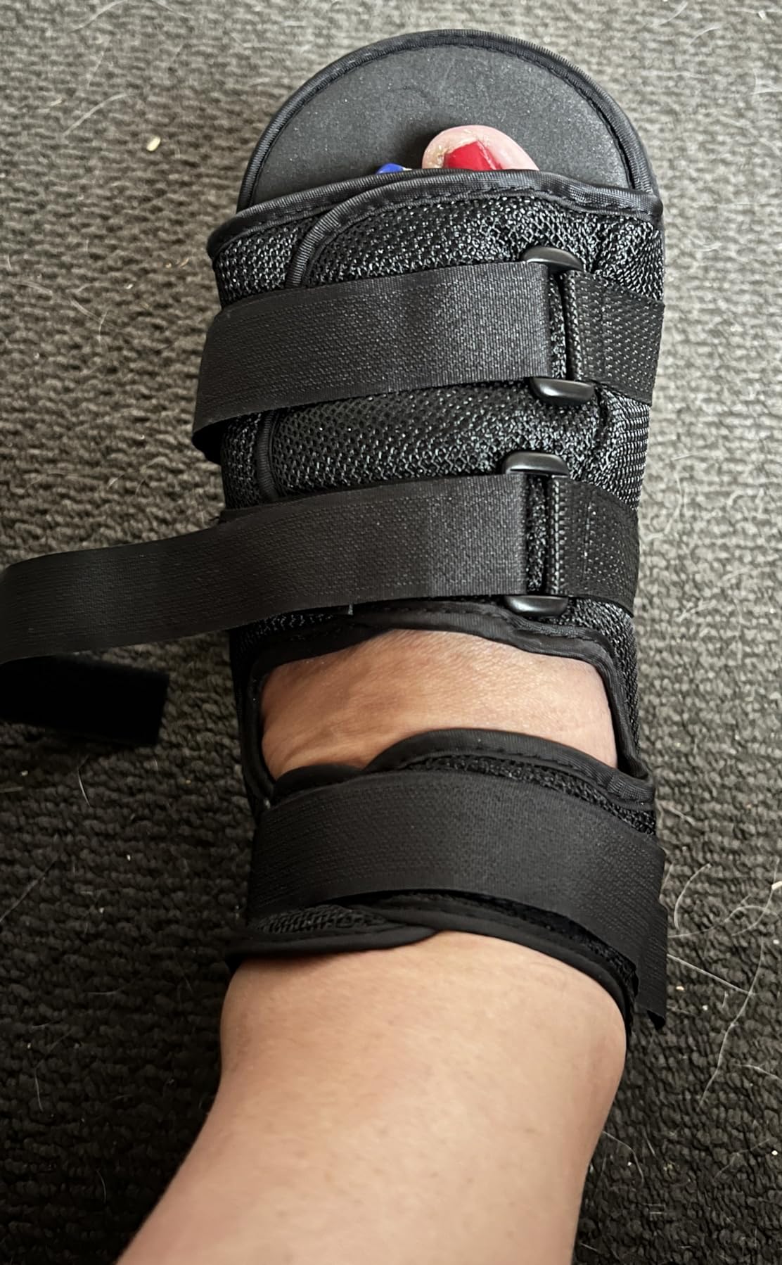 Post op Shoes for Broken Toe Medical Walking shoes Cast Foot Brace for ...