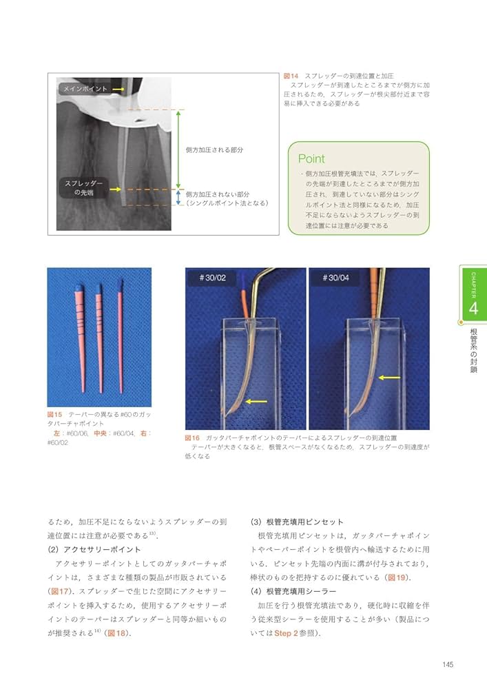大臼歯までピッタリ根充を目指す国境の歯科医のクリニカル・エンドドンティックス AO エンドドンティックス】上顎大臼歯MB根の根管数とその考え方