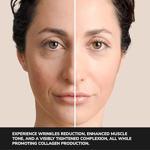 Miniatura 2 de Illume PRO - Dispositivo facial reafirmante y tonificante para el cuidado de la piel