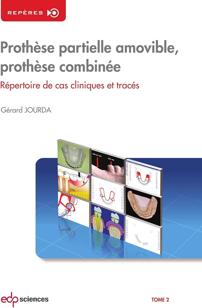 Amazon.co.jp: Prothese Partielle Amovible T2 : 本 Amazon.co.jp: Prothese Partielle Amovible T2 : 本