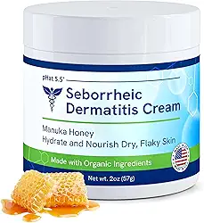 pHat 5.5 Creme hidratante para dermatite seborréica e loção facial para mulheres - vermelhidão calmante para rosto e corpo - creme hidratante facial para pele seca e loção anticoceira (56,7 g)