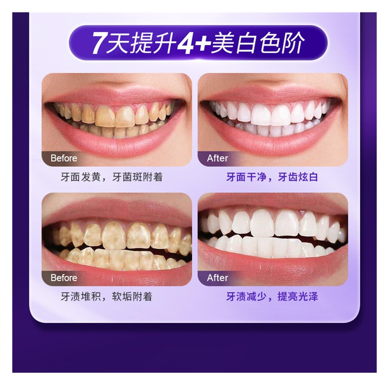 Pasta De Dientes Blanqueadora Y Quitamanchas 100g | Uso de tecnología de luz fría for iluminar los dientes y un aliento fresco y duradero(3pcs)