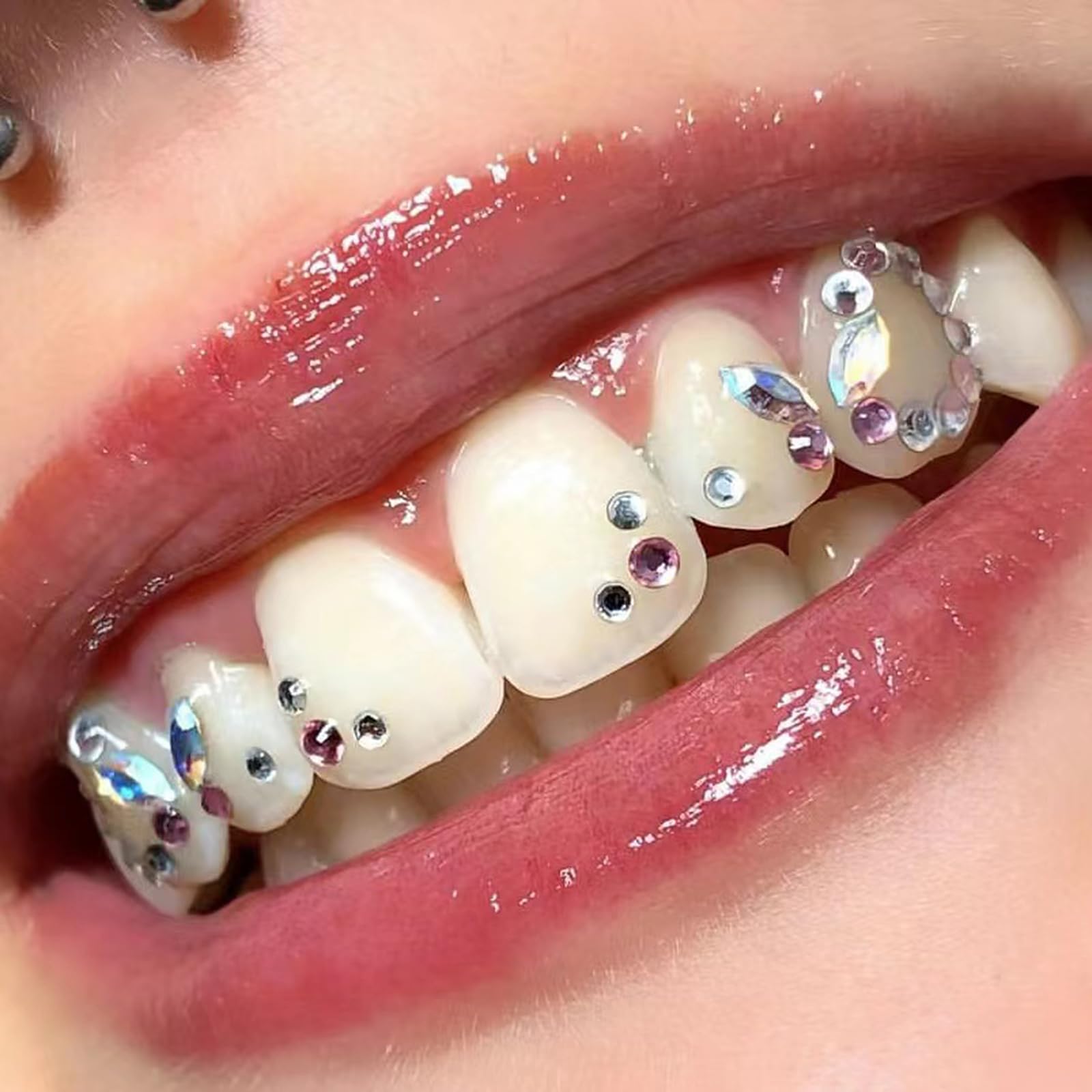 Kit de pierres dentaires professionnelles utilisées pour les bijoux dentaires, les supports orthodontiques