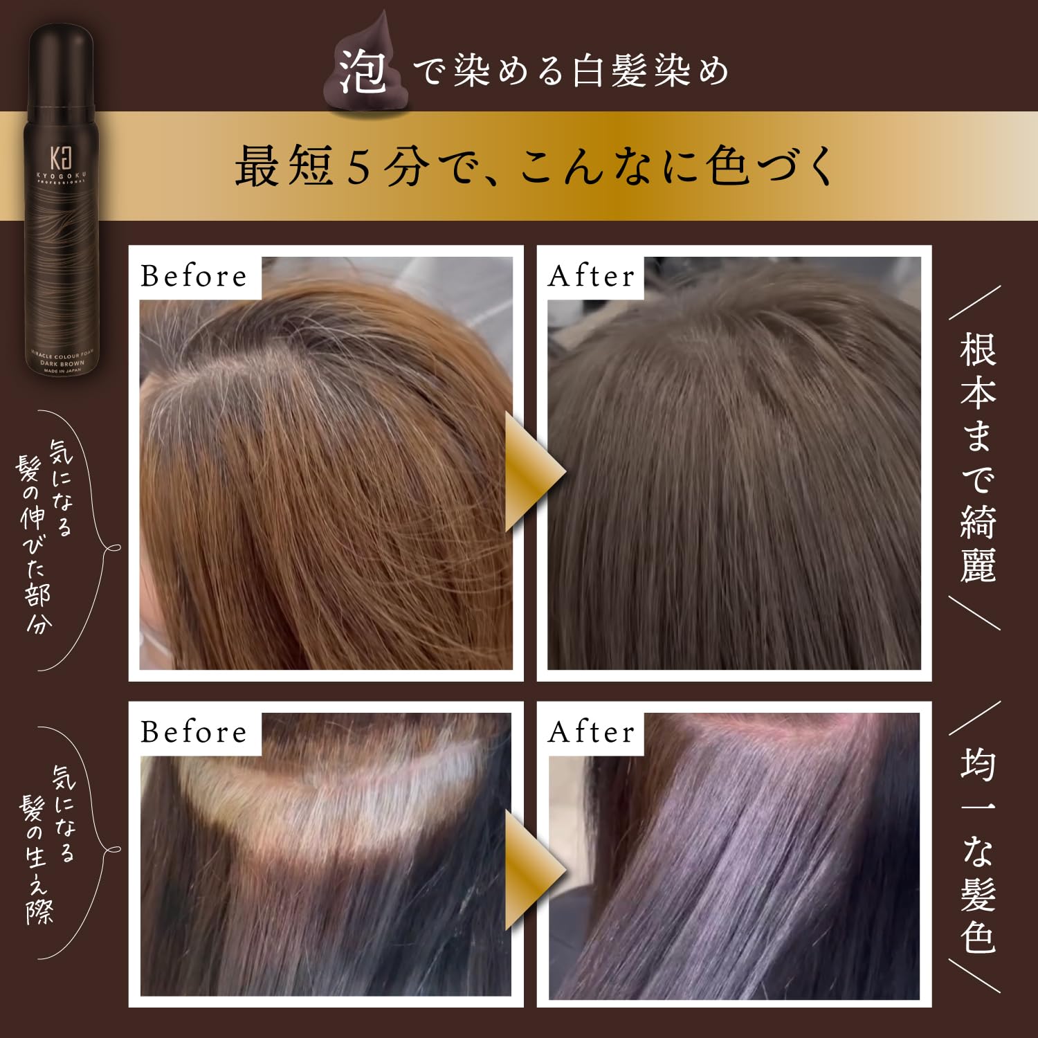 Amazon | Kyogoku ミラクルカラーフォーム ブラック 白髪染め 髪質改善