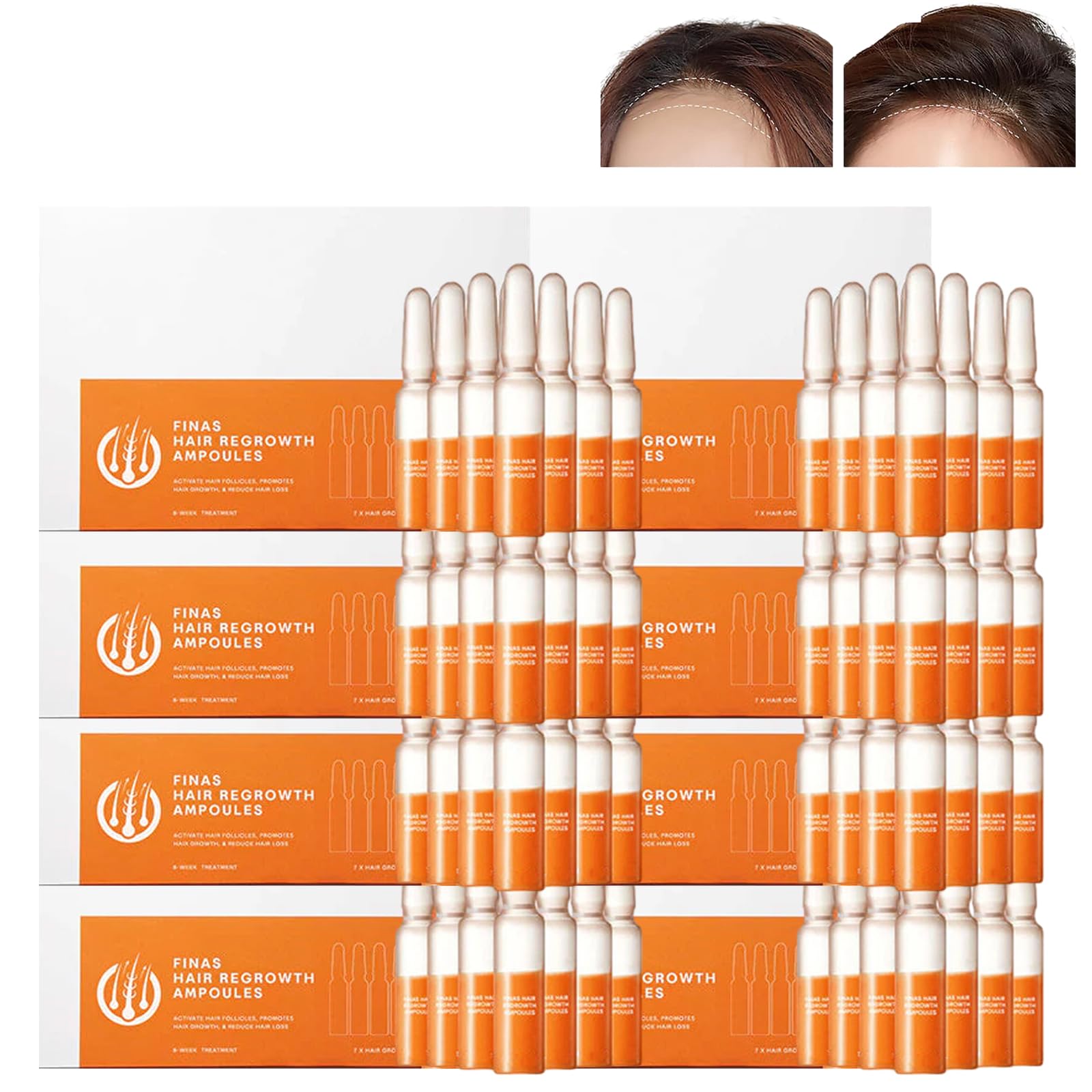 Liasc FINAS Prestig Hair-Regrowth Ampoules,Liasc Hairmuch Hair Growth Ampoule Serum Lotion,Biotin Hair Growth Serum,Hair Loss Thickening Regrowth for Thinning Hair (56 pcs/8 boxes)