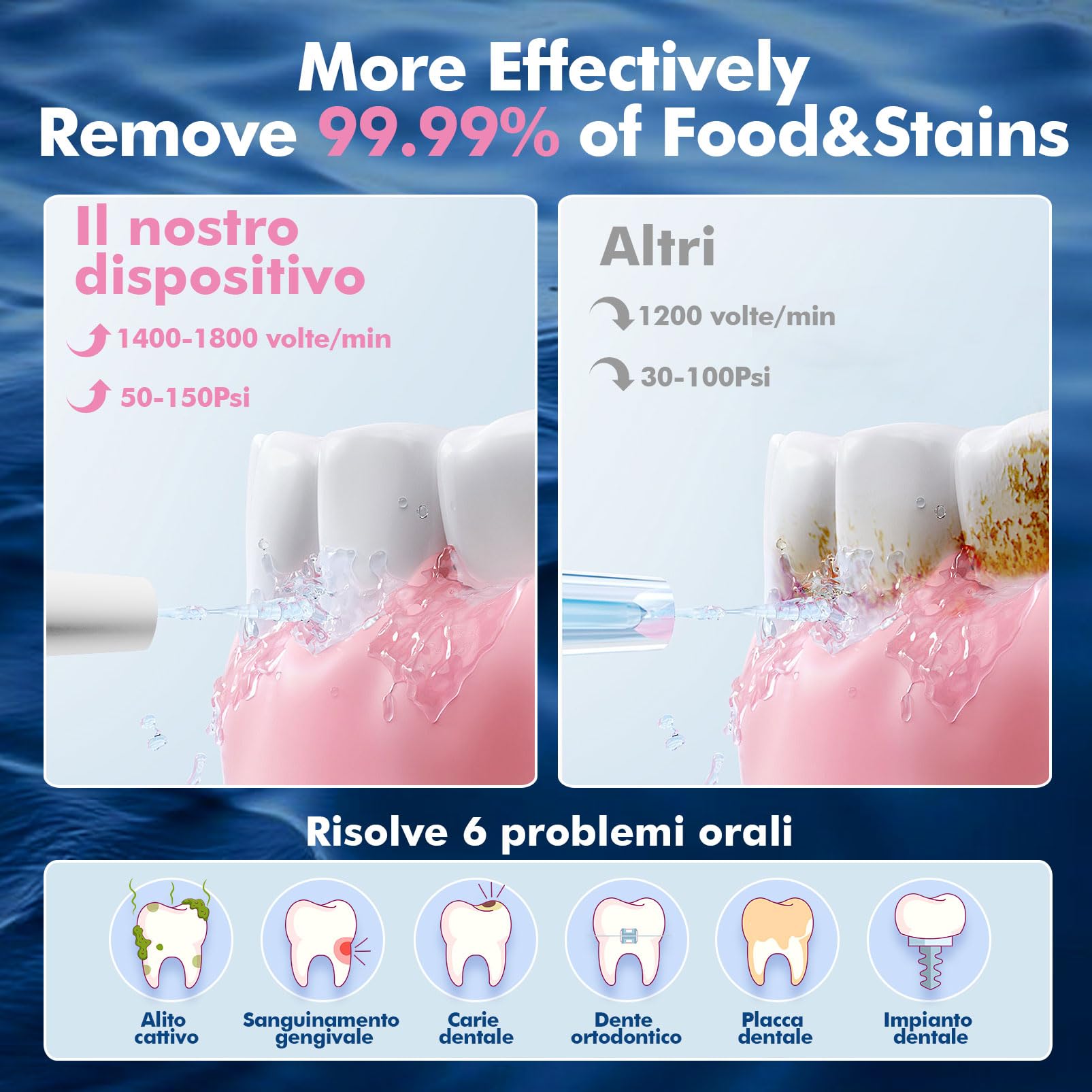 Water Flosser Elettrico Senza Fili con 4 Modalità e 4 Ugelli, Idropulsore Orale IPX7 Impermeabile, Serbatoio da 300ml, per Uso Domestico e da Viaggio - Nero