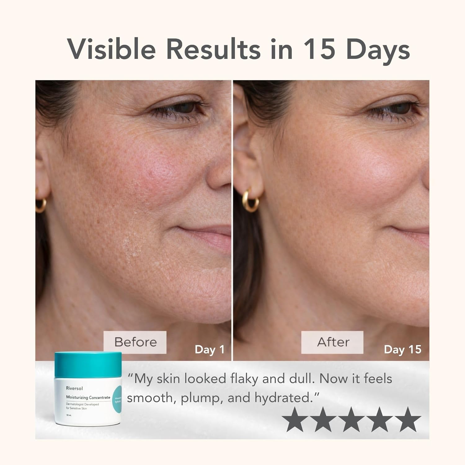 Riversol Daily Moisturizing Concentrate for Very Dry & Rosacea-Prone Skin | Rich Hydrating Face Cream w/Hyaluronic Acid | Deep Hydration & Redness Relief | Dermatologist Developed | Fragrance Free