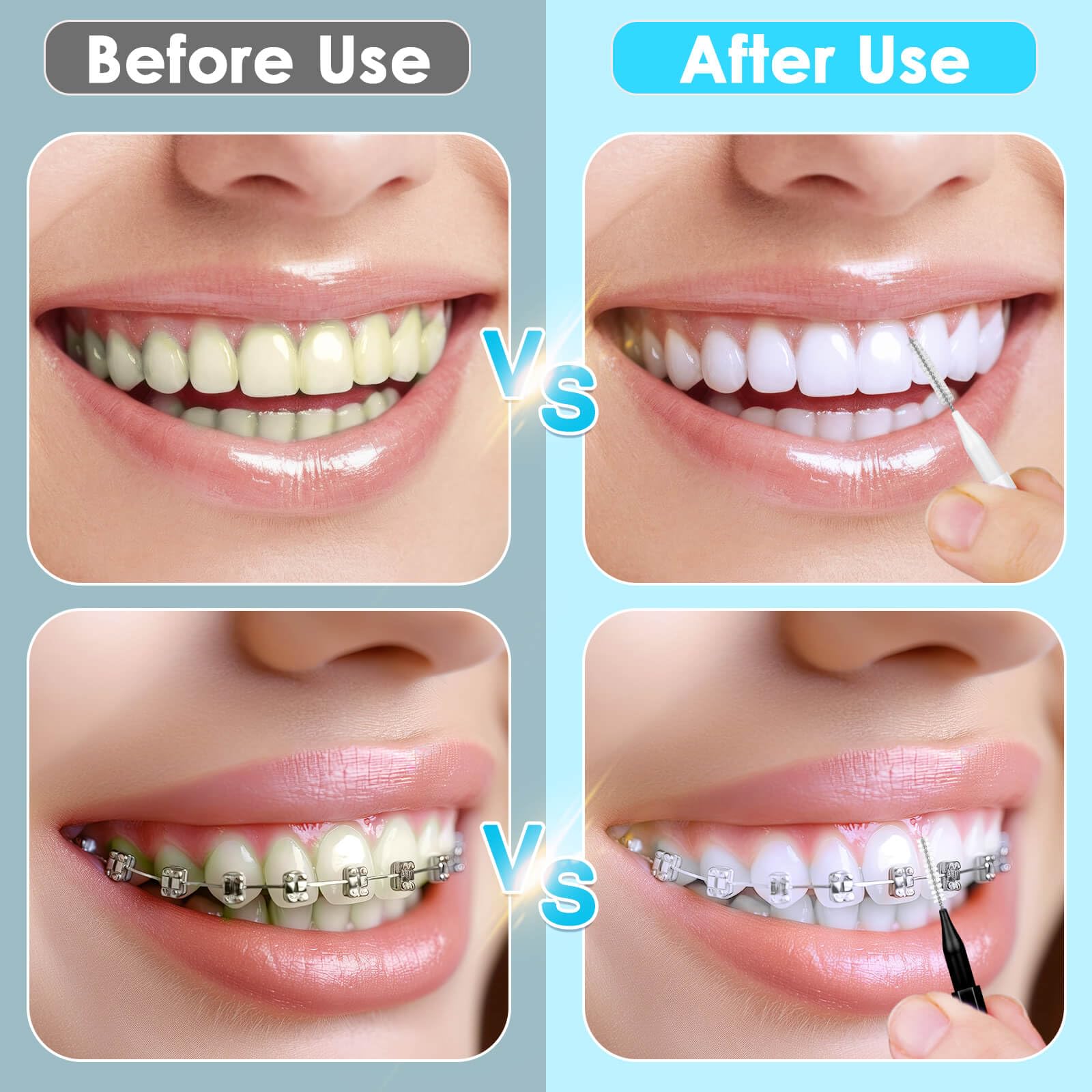 Jupwalz 270 cepillos interdentales, 220 púas dentales suaves y 50 cepillos de tirantes para dientes, cabezales de hilo dental flexibles, cepillos interdentales entre dientes, limpiador de dientes