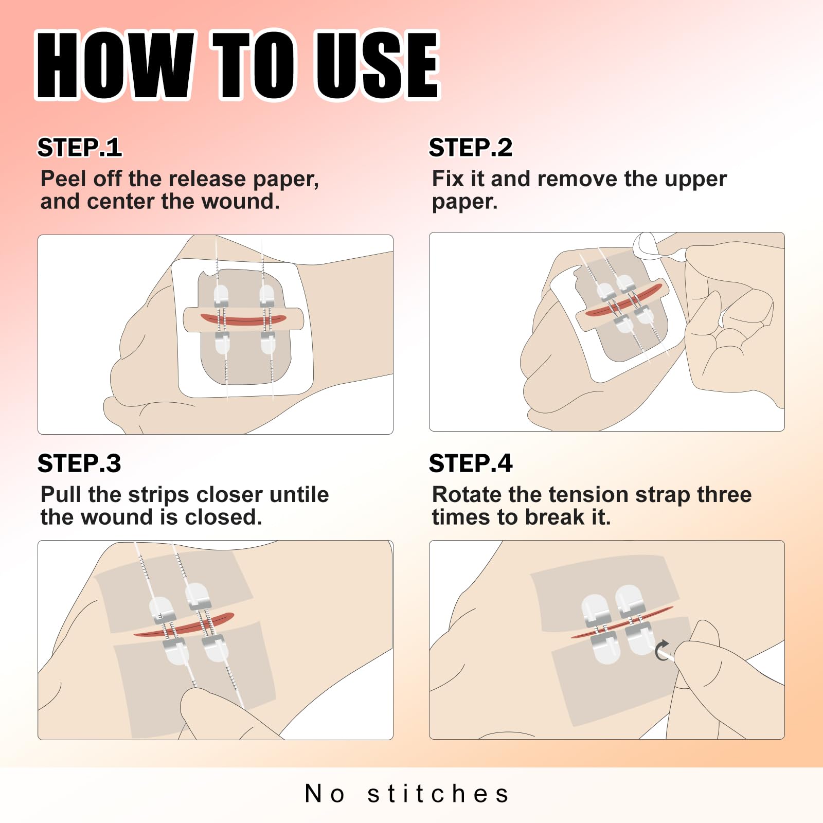 Carbou 4 strisce di chiusura ferita di emergenza, con chiusura lampo, bandaids, set di chiusura a taglio, senza cuciture e facili da usare