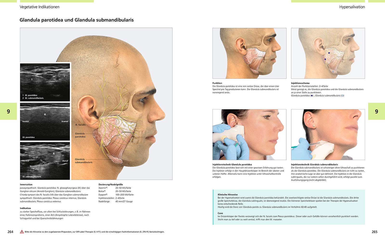 Atlas der Botulinumtoxin-Injektion: Dosierung | Lokalisation | Anwendung