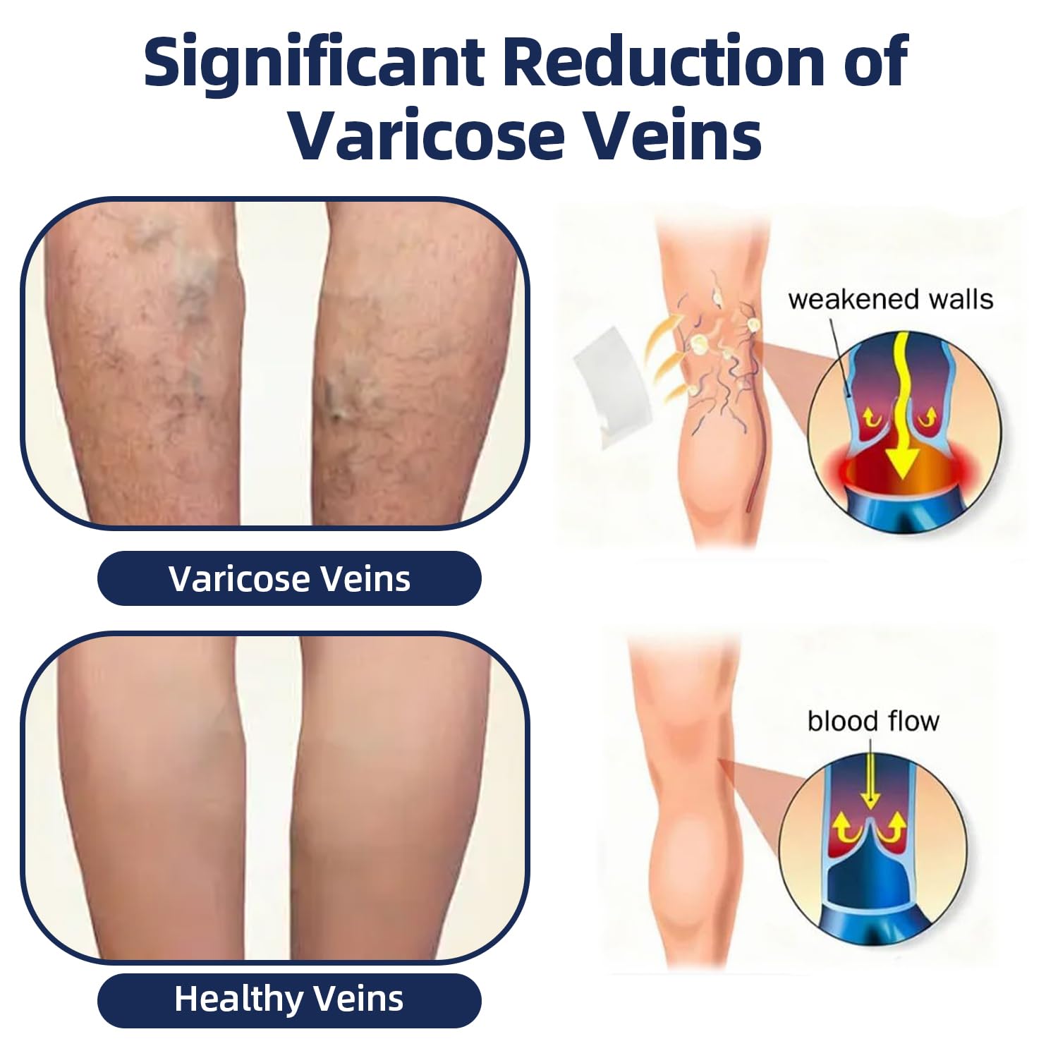 Moon Rind VeinTarget Microdarts Patch, 3 Boxes Leg Vein Relief Patch, Deep Moisturizing & Soothing