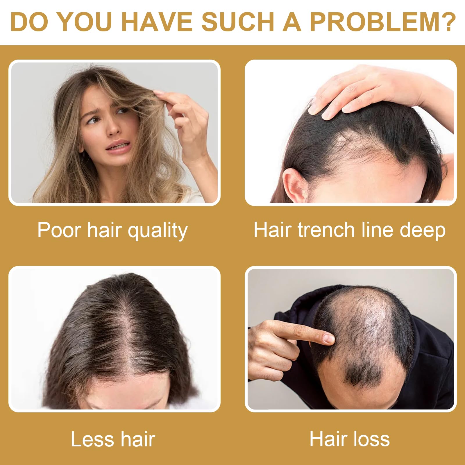 2×30ML Siero Capelli Crescita, Anti-Caduta Dei Capelli Sieri Di Crescita, Promuove una Hair Growth Serum, Rinforza Cuoio Capelluto e Hair, per Uomo e Donna