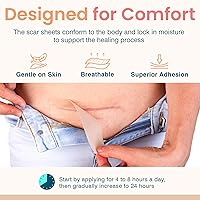 Vista 3 de Cinta de silicona prémium para cicatrices quirúrgicas, hojas de cicatrices de silicona reutilizables y profesionales, cinta médica para queloides