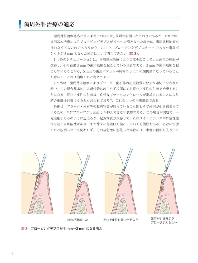 ゼロから見直す歯周外科治療 ゼロから見直す歯周外科治療 | 松延 允資 |本 | 通販 | Amazon