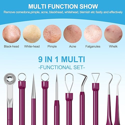 Miniatura 2 de Herramientas removedoras de puntos negros, raspador facial para limpieza profunda, kit de herramientas para reventar espinillas, espátula facial,