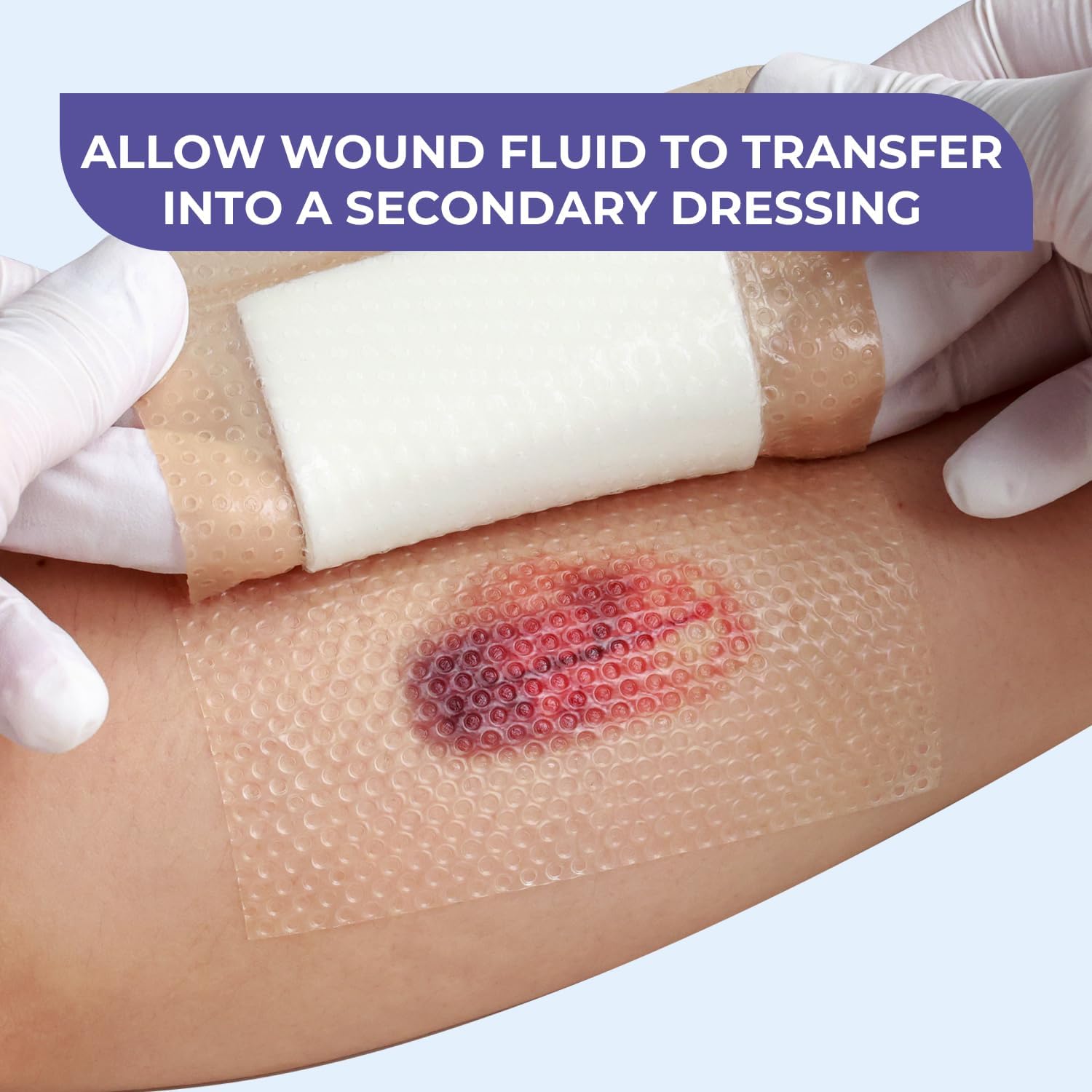 Conkote Silicone Wound Contact Layer Dressing 3"x4", FSA or HSA Transparent Adaptic Wound Dressing for Skin Tear, Prevent Wound Adherence, Box of 10 Dressing - Image 3