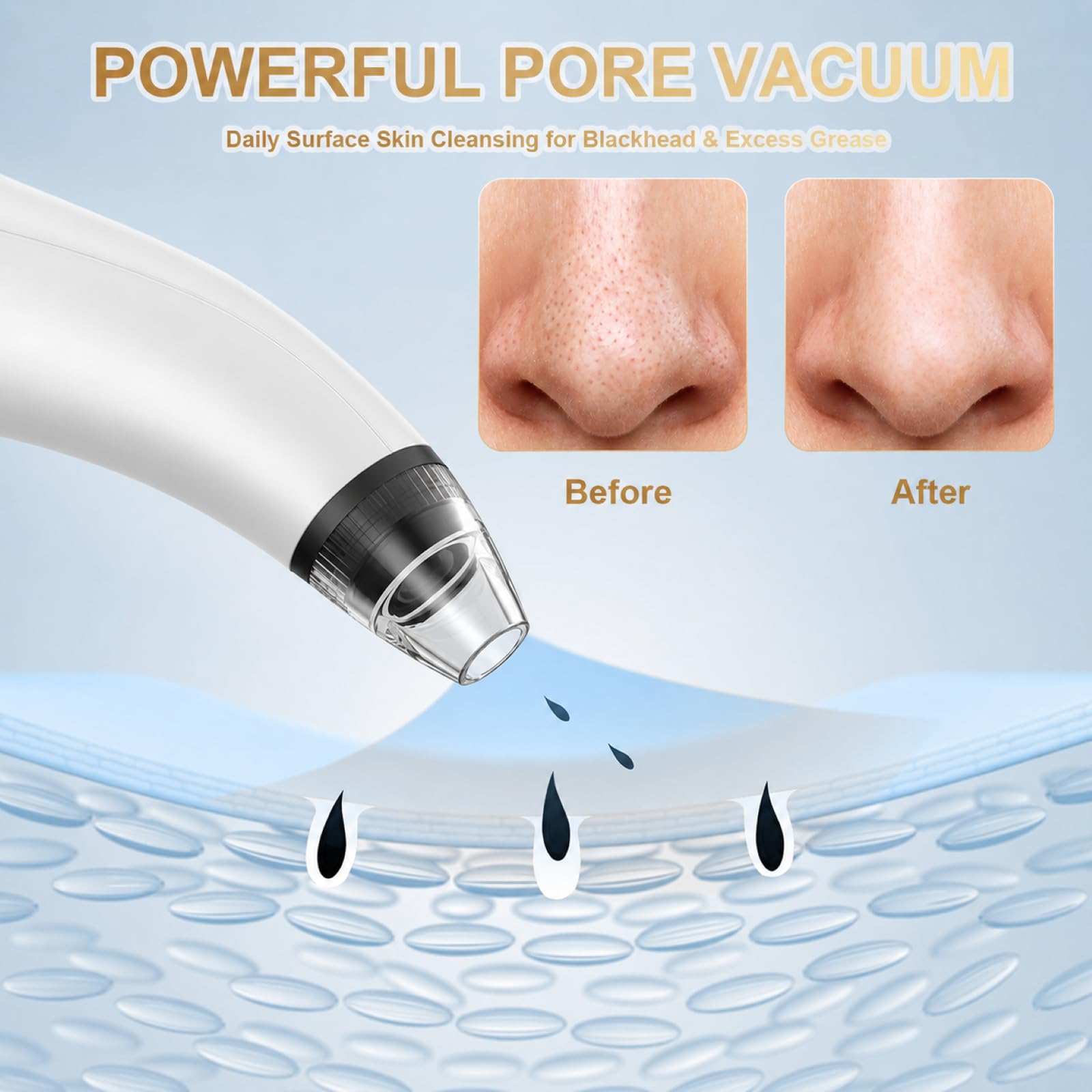 Blackhead Remover Tool, Aooeou Professional Pimple Popper Tool Kit - Easy Removal for Blemish, Whitehead Popping, Zit Removing for Risk Free Nose Face, Anti-Slip Coating Handle (b-Silver) view 7