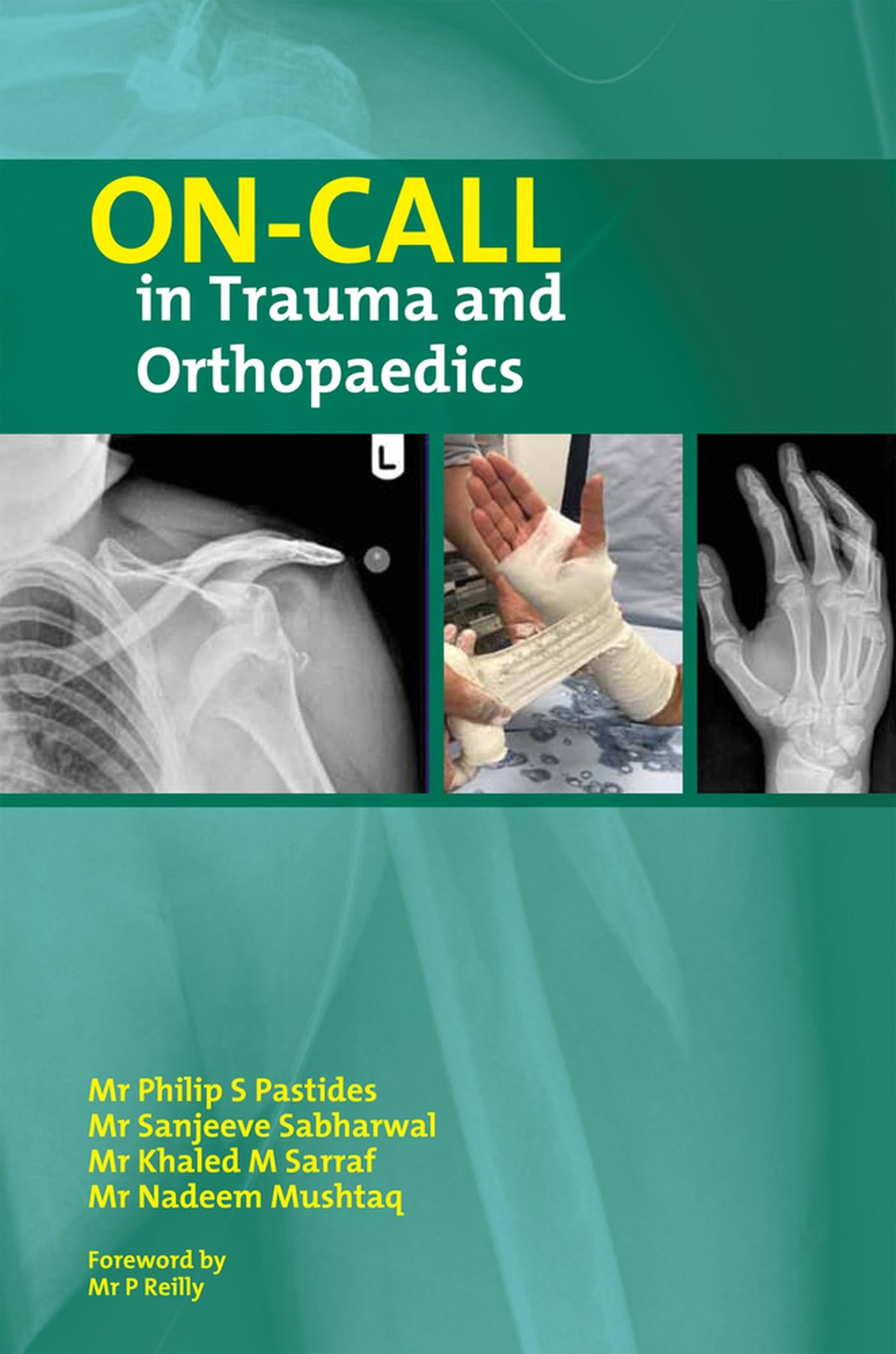 On-Call in Trauma and Orthopaedics