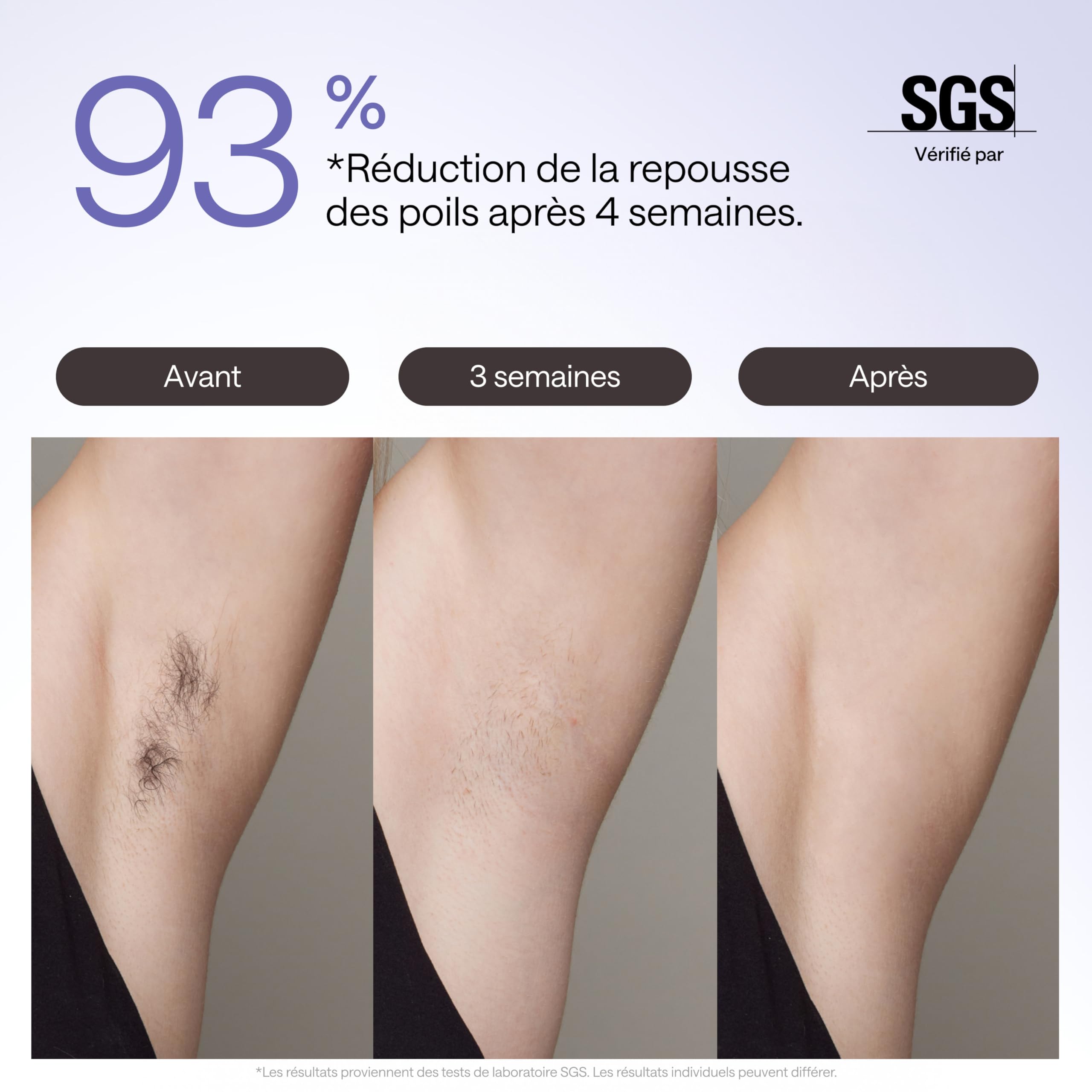 Épilateur à Lumière Pulsée Ulike Air 3 Deluxe, Sans Douleur Alternative au Laser, Convient aux Peaux Sensibles, 4 accessoires pour le corps, le visage, le maillot et les aisselles