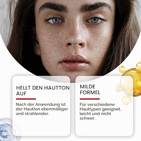Pigment Spot Remover Cream Face Whitening Cream Against Dark Spots Dark Spot Remover for the Body Dark Spot Correction Cream for Armpits Inner Thigh and Intimate Areas (1)