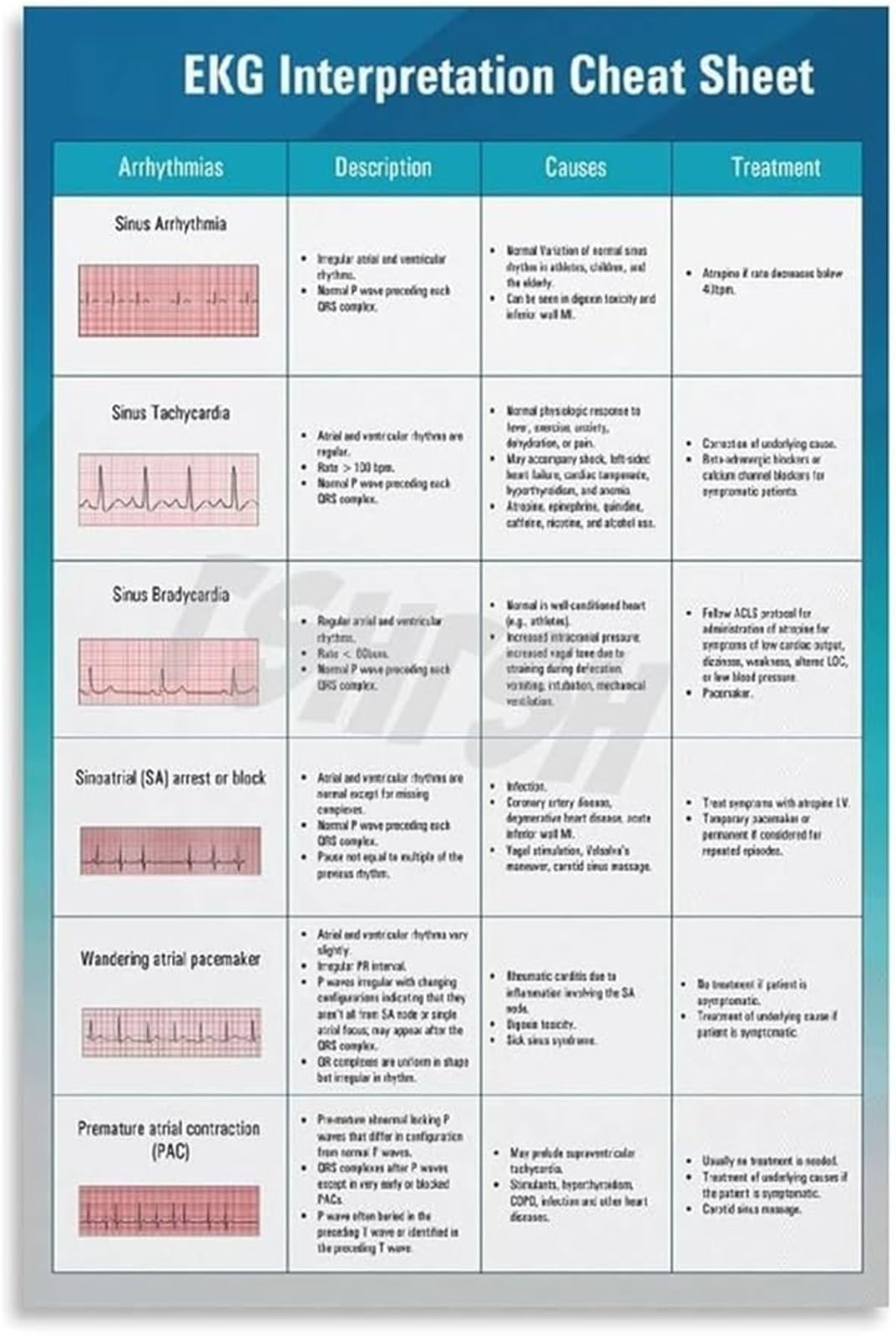 Poster ECG de formation médicale et schéma de placement électrodes encadré