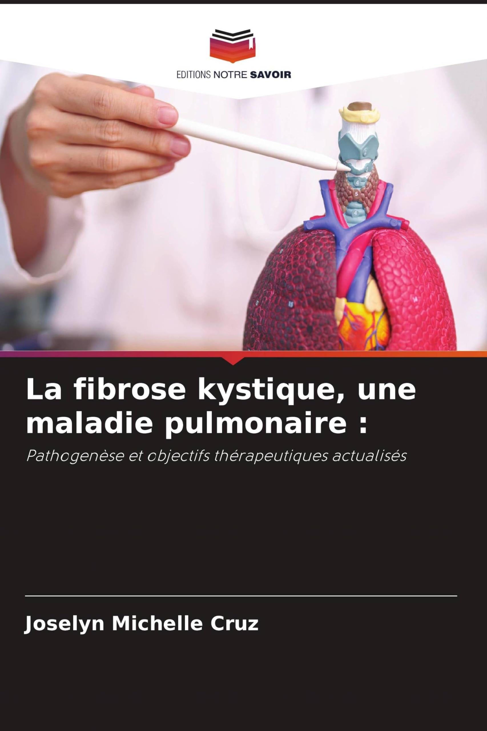 La fibrose kystique, une maladie pulmonaire :: Pathogenèse et objectifs thérapeutiques actualisés