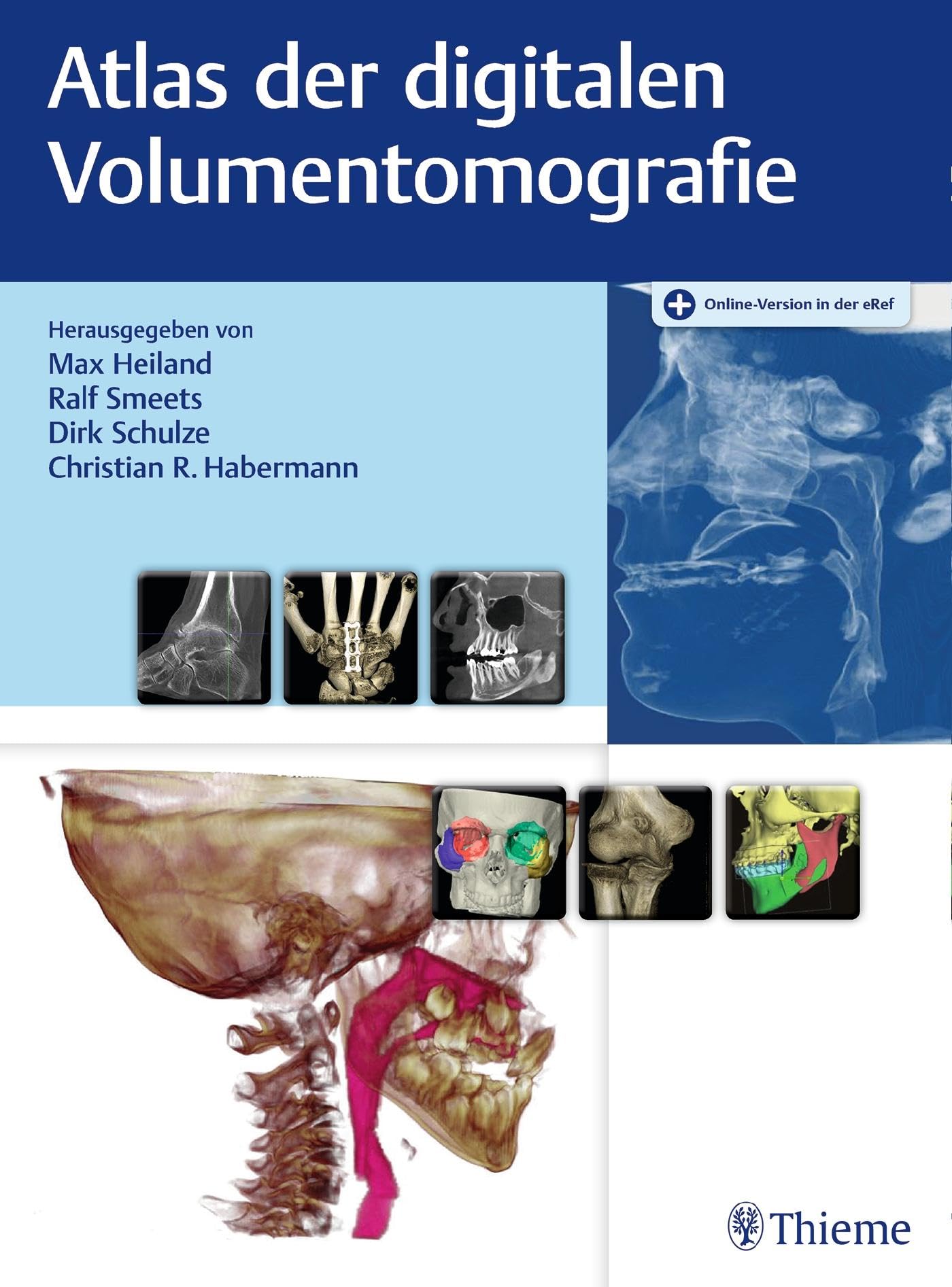 Atlas der digitalen Volumentomografie: Online-Version in der eRef