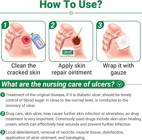 Miniatura 6 de LMNOOP Ungüento curativo de úlceras cutáneas, para úlceras de pies y piernas, llagas, úlceras varicosas, úlceras por estasis, úlceras por decúbito,
