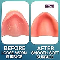Vista 6 de Prosoft revestimiento para dentaduras postizas 2 placas para dentaduras postizas.