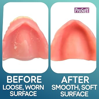 ProSoft Denture Reliner - 2 Denture Plates Relines