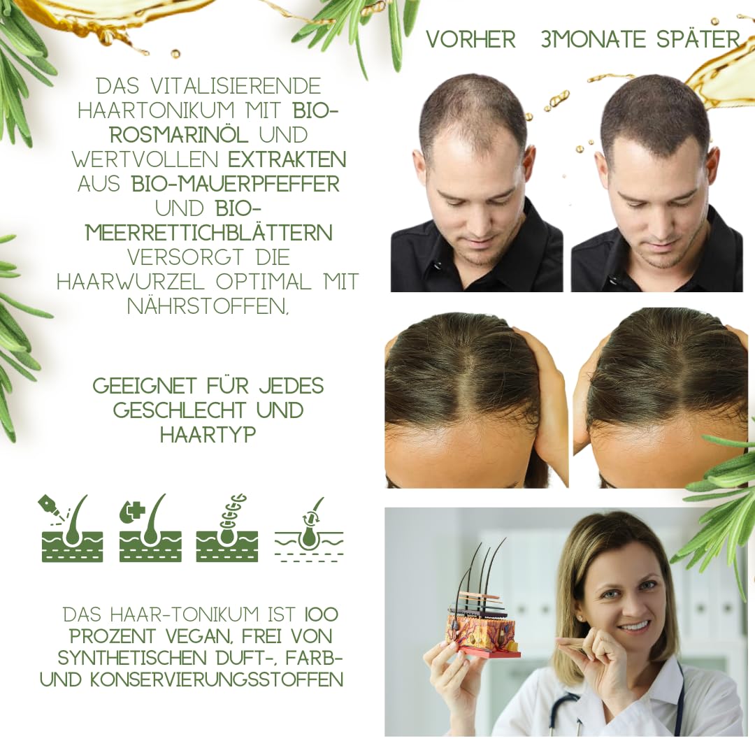 170 ml - Applicateur de racine de cheveux compatible avec WELEDA bio romarin cosmétique naturel - Tonique capillaire tonique à l'huile de romarin - Prévient la chute des cheveux (Vegan) 100ml