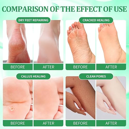 Miniatura 58 de Kit de pedicura para pies remojados: sal de burbujas, exfoliante de azúcar, máscara de masaje, loción de masaje en una caja, kit de spa de 4 pasos