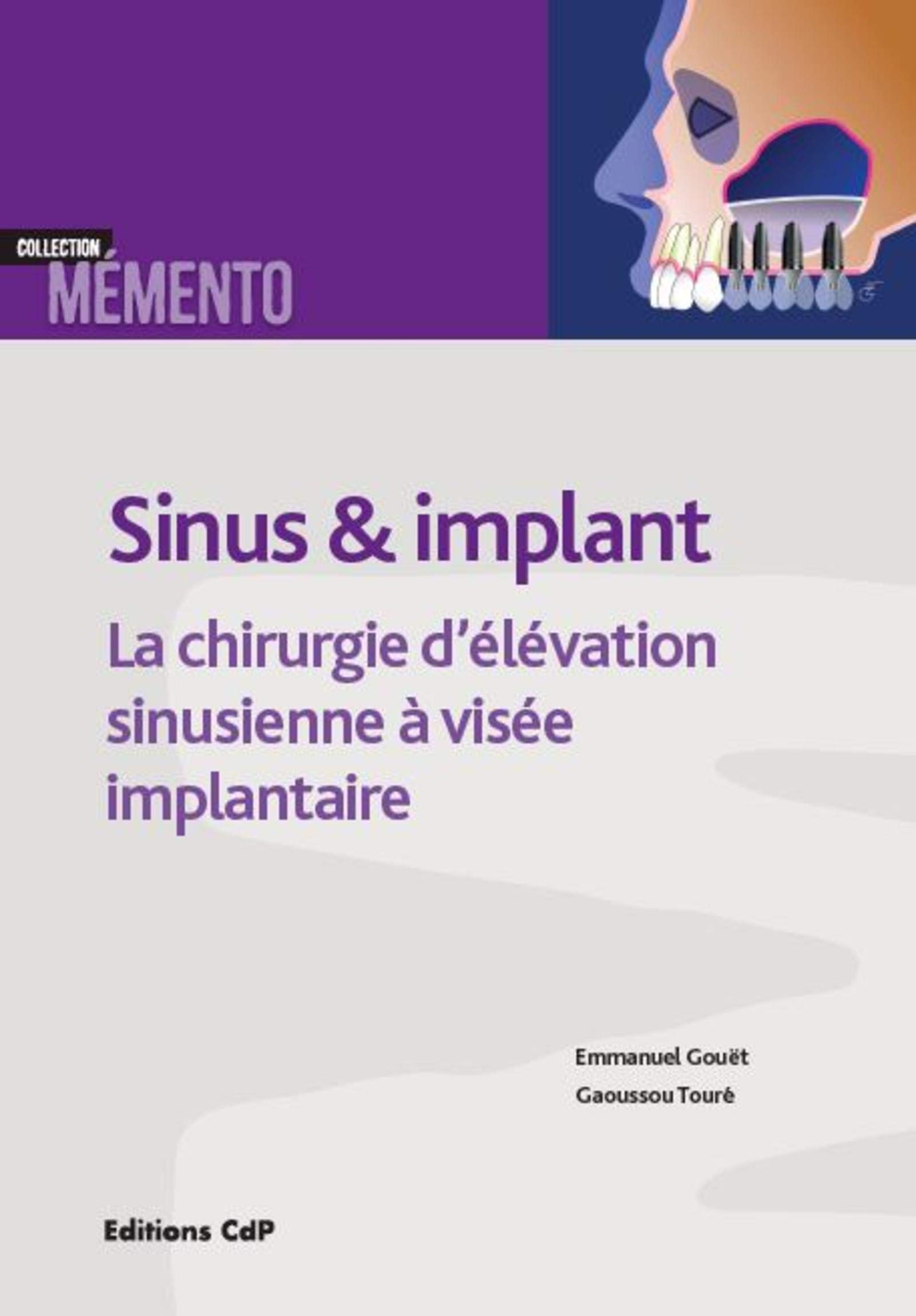 Sinus et implants: La chirurgie d'élévation sinusienne à visée implantaire