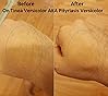 Dermaharmony 2% Pyrithione Zinc (ZnP) Bar Soap 4 oz - Crafted for Those with Skin Conditions - Seborrheic Dermatitis, Dandruff, Psoriasis, Eczema, etc