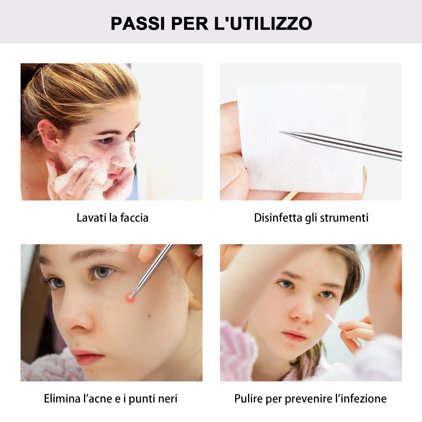 Kit di Strumenti Rimozione Punti Neri 5 Pezzi, Blackhead Estrattore Ago Acne in Acciaio Inossidabile con Scatola, per il Trattamento e la Togli di Comedoni sul Naso o Viso