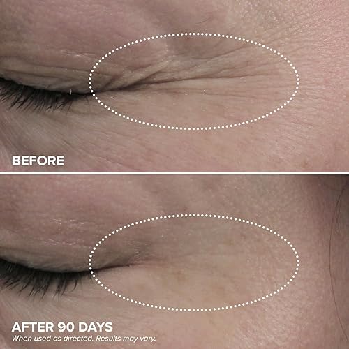 Miniatura 3 de DRMTLGY HPR Eye Cream - Crema retinoide debajo de los ojos para debajo de los ojos, 0.5 fl oz