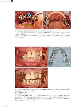 ブリッジ・部分床義歯の支台歯選択 | 和田 淳一郎, 駒田 亘