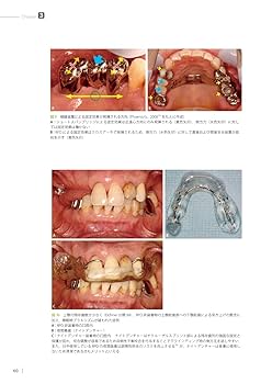 咬合挙上 その意思決定と臨床手技　和田淳一郎・若林則幸著 咬合挙上: その意思決定と臨床手技 | 和田淳一郎, 若林則幸 |本