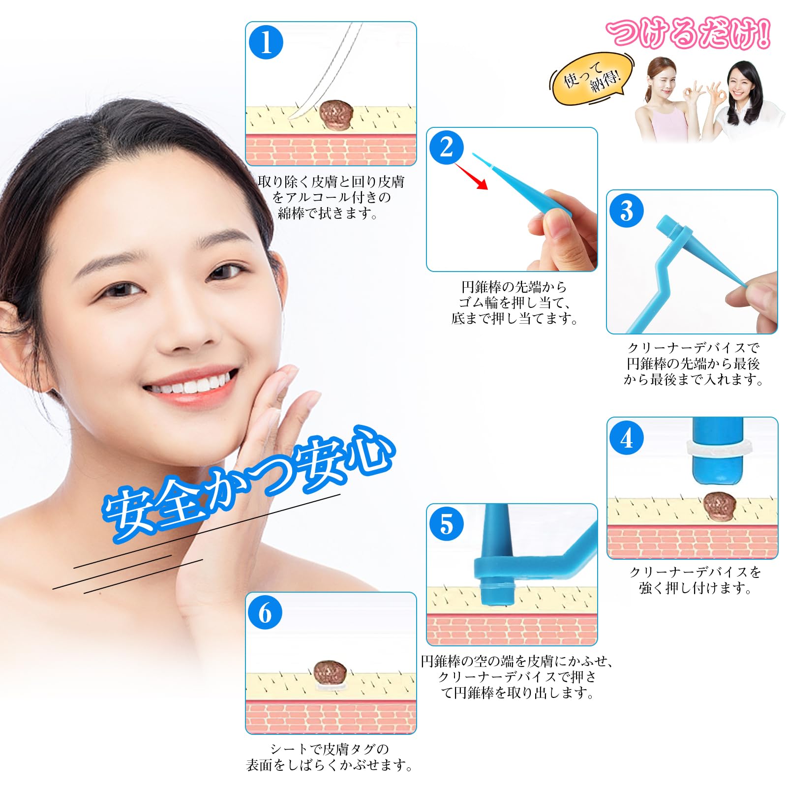 Nikiboさん　専用　イボ Amazon.co.jp: イボ取りツール スキンタグ取り外しキット 4つサイズ