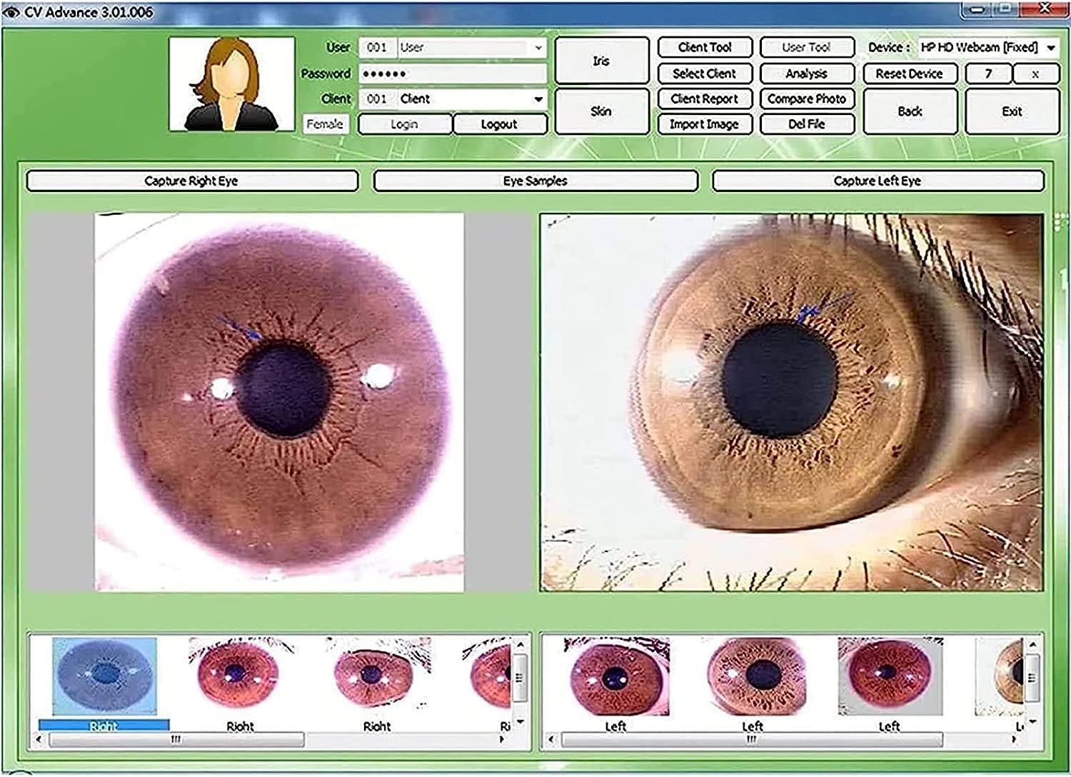 Przenośna kamera irydologiczna 5.0 MP USB HD 2 miliony pikseli Detektor tęczówki Lupa tęczówki Oprogramowanie Iris Analizator komputerowy Irydologia Kamera komputerowa 30X