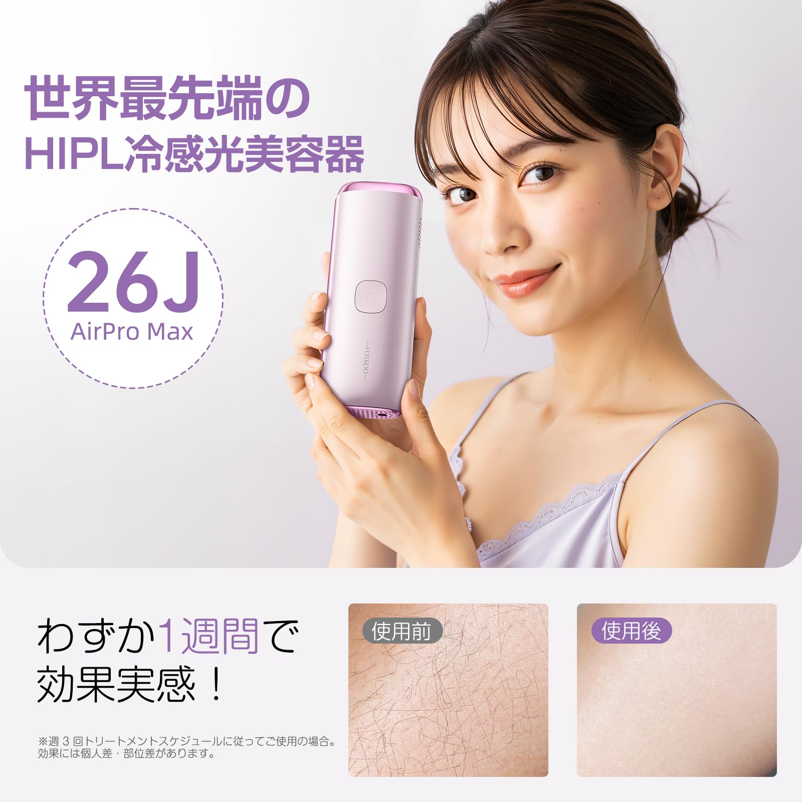 Amazon | 脱毛器 HIPL 光美容器 26J 自動連続照射 【エステティシャン