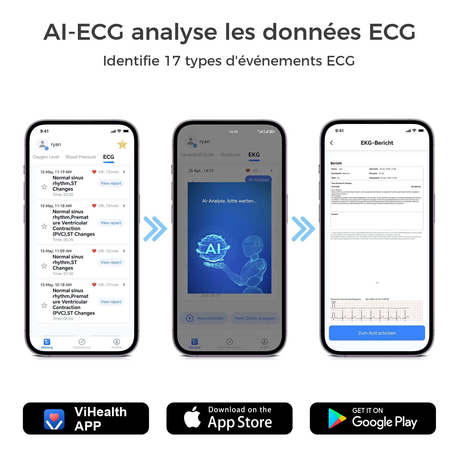 Wellue LP12 ECG portable 12 dérivations avec écran OLED, enregistrement de l'ECG en temps réel sur 24 heures, rapports AI ECG détaillés, marqueurs d'événements, Support pour Smartphone APP et PC